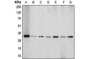 Western blot analysis of Aquaporin 4 expression in HeLa (A), Jurkat (B), PC12 (C), SP2/0 (D), HepG2 (E), U87MG (F), mouse brain (G) whole cell lysates. (Aquaporin 4 antibody  (Center))