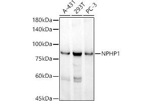 Western blot analysis of extracts of various cell lines, using NPHP1 antibody (ABIN7268847) at 1:1000 dilution. (NPHP1 antibody)