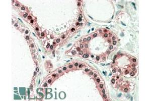 ABIN334523 (5µg/ml) staining of paraffin embedded Human Thyroid Gland. (UXT antibody  (C-Term))