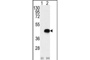 Western blot analysis of BCKDK (arrow) using rabbit polyclonal BCKDK Antibody (Center) (ABIN391176 and ABIN2841276). (BCKDK antibody  (AA 120-151))