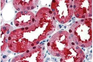 Human Kidney (formalin-fixed, paraffin-embedded) stained with EN2 antibody ABIN462164 followed by biotinylated goat anti-rabbit IgG secondary antibody ABIN481713, alkaline phosphatase-streptavidin and chromogen. (EN2 antibody  (C-Term))