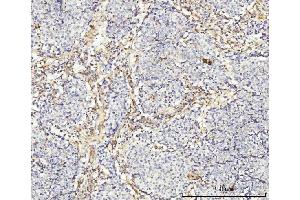 IHC analysis of MT-ND5 using anti-MT-ND5 antibody (ABIN7600145).