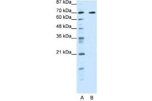 WB Suggested Anti-FOXK2  Antibody Titration: 0.