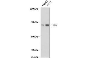 Western blot analysis of extracts of various cell lines, using CBS Rabbit mAb (ABIN7266615) at 1:1000 dilution.
