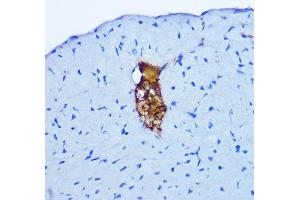 Immunohistochemistry of paraffin-embedded mouse heart using GRP Rabbit pAb (ABIN6127573, ABIN6141433, ABIN6141434 and ABIN6222002) at dilution of 1:100 (40x lens). (Gastrin-Releasing Peptide antibody  (AA 1-148))