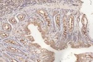 Immunohistochemistry analysis of paraffin-embedded rat colon using,PFDN4 (ABIN7075171) at dilution of 1: 4200 (PFDN4 antibody)