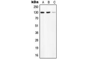 Western blot analysis of PLC beta 2 expression in HeLa (A), SP2/0 (B), H9C2 (C) whole cell lysates. (Phospholipase C beta 2 antibody  (Center))