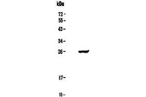 Western blot analysis of Serum Amyloid P using anti-Serum Amyloid P antibody .