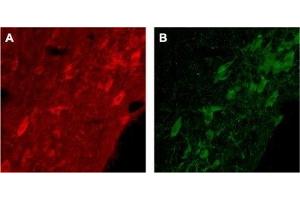 Expression of p75NTR in rat brainImmunohistochemical staining of rat brain with Anti-p75 NGF Receptor (extracellular) Antibody (ABIN7043344, ABIN7044755 and ABIN7044756). (Nerve Growth Factor Receptor (NGFR) Peptide)