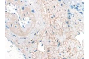 Detection of ELN in Human Liver Tissue using Monoclonal Antibody to Elastin (ELN) (Elastin antibody  (AA 392-645))