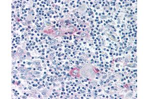 Anti-ROR Gamma antibody IHC of human thymus. (RORC antibody  (Ligand Binding Domain))