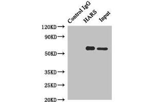 Immunoprecipitating HARS in Hela whole cell lysate Lane 1: Rabbit control IgG instead of (1 μg) instead of ABIN7155257 in Hela whole cell lysate. (HARS1/Jo-1 antibody  (AA 1-180))