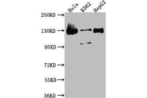 Western Blot Positive WB detected in: Hela whole cell lysate, K562 whole cell lysate, HepG2 whole cell lysate All lanes: Bub1 antibody at 1:1000 Secondary Goat polyclonal to rabbit IgG at 1/50000 dilution Predicted band size: 123, 116, 120 kDa Observed band size: 130 kDa (Recombinant BUB1 antibody)