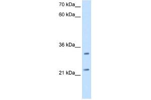 WB Suggested Antibody Titration:  2. (C21orf33 antibody  (N-Term))