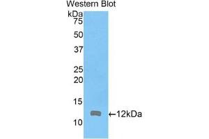 Detection of Recombinant ARPC4, Mouse using Polyclonal Antibody to Actin Related Protein 2/3 Complex Subunit 4 (ARPC4) (ARPC4 antibody  (AA 79-164))