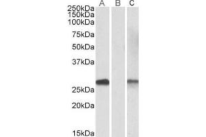 Lane A - ABIN571107 (1µg/ml) staining of HEK293 overexpressing Human DYDC1 lysate (10µg protein in RIPA buffer) Lane B - ABIN571107 (0.