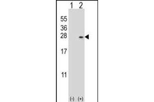 Western blot analysis of DUSP14 (arrow) using rabbit polyclonal DUSP14 Antibody (M1) (ABIN392877 and ABIN2842285). (DUSP14 antibody  (N-Term))