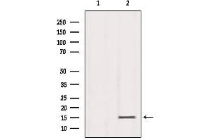 Western blot analysis of extracts from Mouse Spleen, using Histone H3K79me3 Antibody. (Histone 3 antibody  (H3K79me3))
