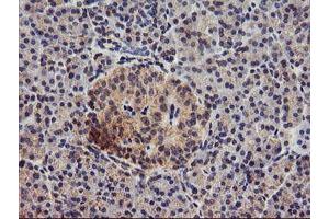 Immunohistochemical staining of paraffin-embedded Human pancreas tissue using anti-DGKA mouse monoclonal antibody. (DGKA antibody)