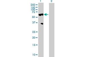 Western Blot analysis of HABP2 expression in transfected 293T cell line by HABP2 MaxPab polyclonal antibody. (HABP2 antibody  (AA 1-560))