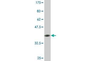 Western Blot detection against Immunogen (36. (Keratin 75 antibody  (AA 141-240))