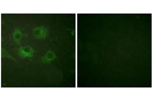 Immunofluorescence analysis of HuvEc cells, using Claudin 3 antibody (ABIN5976357). (Claudin 3 antibody  (C-Term))