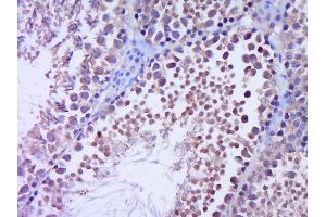 Immunohistochemistry (Paraffin-embedded Sections) (IHC (p)) image for anti-Zinc Finger Protein GLI1 (GLI1) (AA 601-700) antibody (ABIN673374)