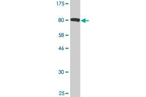 Western Blot detection against Immunogen (91. (IGF2BP2 antibody  (AA 1-598))
