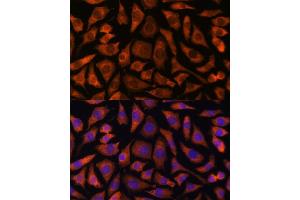 Immunofluorescence analysis of L929 cells using RABGGTA antibody (ABIN7269783) at dilution of 1:100. (RABGGTA antibody  (AA 240-360))