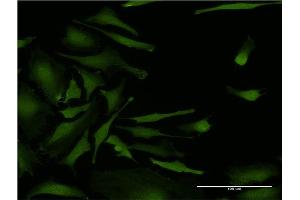 Immunofluorescence of monoclonal antibody to CSNK2A2 on HeLa cell. (CSNK2A2 antibody  (AA 1-100))