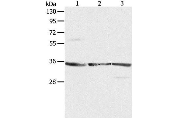 RPLP0 antibody