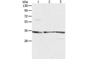 Western Blot analysis of NIH/3T3, A431 and Jurkat cell using RPLP0 Polyclonal Antibody at dilution of 1:750 (RPLP0 antibody)