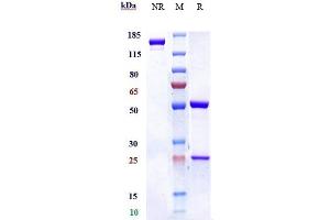 Anti-IL-5 Reference Antibody (mepolizumab) on SDS-PAGE under reducing (R) condition. (Recombinant IL5 (Mepolizumab Biosimilar) antibody)