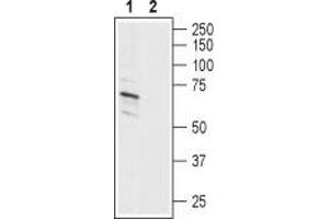 Western blot analysis of human SH-SY5Y neuroblastoma cell line lysate:1. (Amiloride-Sensitive Cation Channel 2, Neuronal (ACCN2) Peptide)