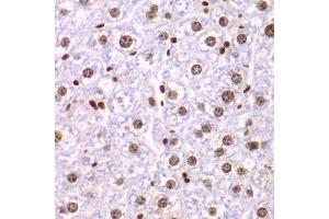 Immunohistochemistry of paraffin-embedded mouse liver using SSRP1 antibody. (SSRP1 antibody  (AA 1-300))