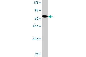 Western Blot detection against Immunogen (66. (beta Actin antibody  (AA 1-375))