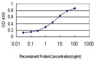 Detection limit for recombinant GST tagged SF1 is approximately 0. (Splicing Factor 1 antibody  (AA 1-110))