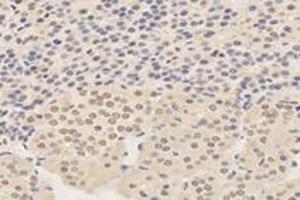 Immunohistochemistry analysis of paraffin-embedded rat adrenal gland using,TPRKB (ABIN7075943) at dilution of 1: 4200 (TPRKB antibody)