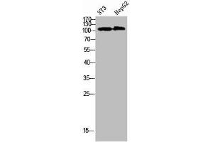 Western Blot analysis of 3T3 HEPG2 cells using Collagen alpha-1(XXVIII)Polyclonal Antibody diluted at 1:1000. (COL28A1 antibody  (AA 111-160))