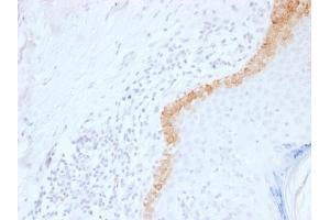 Formalin-fixed, paraffin-embedded human Skin stained with Cytokeratin 15 Mouse Monoclonal Antibody (LHK15). (KRT15 antibody  (C-Term))