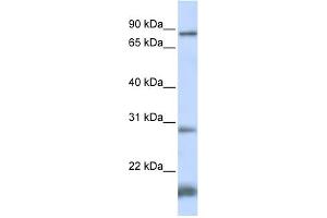 WB Suggested Anti-SMYD4 Antibody Titration:  0. (SMYD4 antibody  (N-Term))