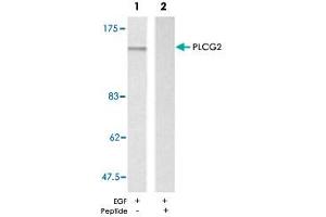 Western blot analysis of exreacts from A-431 cells untreated or treated with EGF (200 ng/mL, 5 min) using PLCG2 polyclonal antibody . (Phospholipase C gamma 2 antibody)