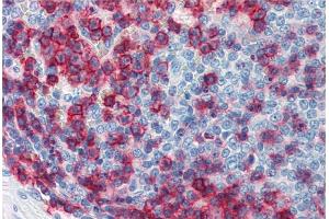 Immunohistochemistry staining of human spleen (paraffin sections) using anti-CD43 (MEM-59). (CD43 antibody)