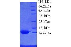 Serum Amyloid A1 (SAA1) (AA 1-110), (full length) protein (His tag) (SAA1 Protein (AA 1-110, full length) (His tag))