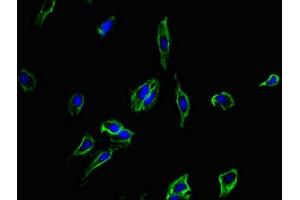 Immunofluorescent analysis of Hela cells using ABIN7173887 at dilution of 1:100 and Alexa Fluor 488-congugated AffiniPure Goat Anti-Rabbit IgG(H+L) (CD4 antibody  (AA 21-193))