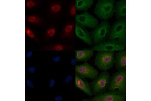 ABIN6259857 and ABIN6266711 staining  cells by IF/ICC. (AKAP8 antibody  (Internal Region))