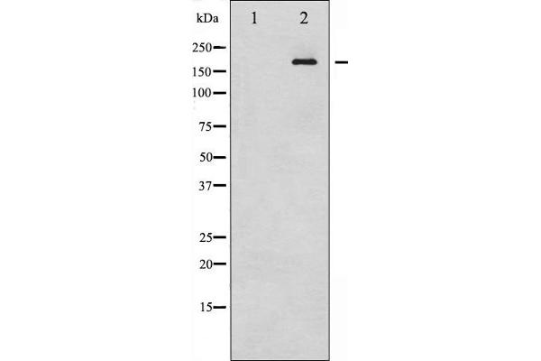 IRS1 antibody  (pSer312)