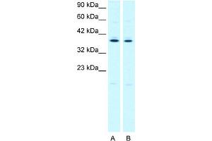 WB Suggested Anti-PTGER3 Antibody Titration:  2. (PTGER3 antibody  (C-Term))