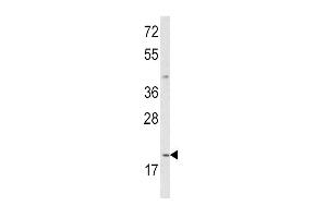 Western blot analysis of IL12A Antibody (C-term) (ABIN652744 and ABIN2842492) in MDA-M cell line lysates (35 μg/lane). (IL12A antibody  (C-Term))