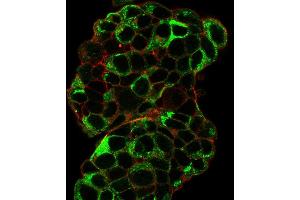Immunofluorescence (IF) image for anti-Trefoil Factor 1 (TFF1) antibody (ABIN6940690)